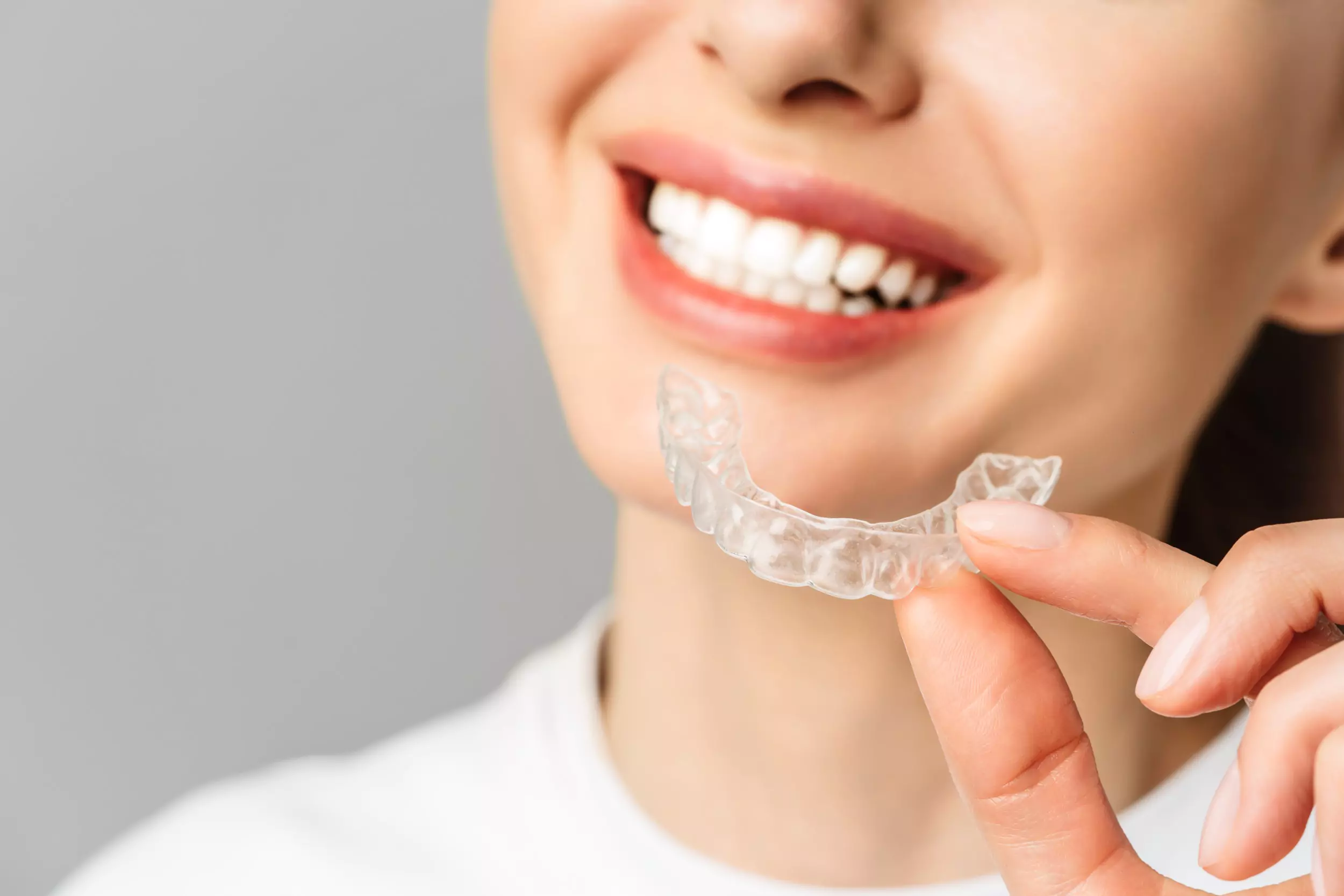 invisalign Bristol
